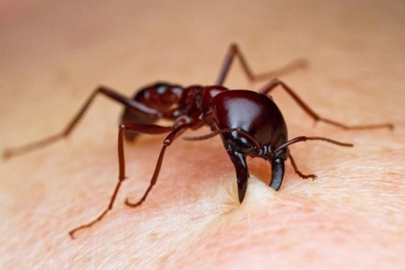 34 Home Remedies For Ant Bites Swelling And Itching 