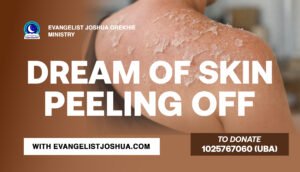 Dream Of Skin Peeling Off